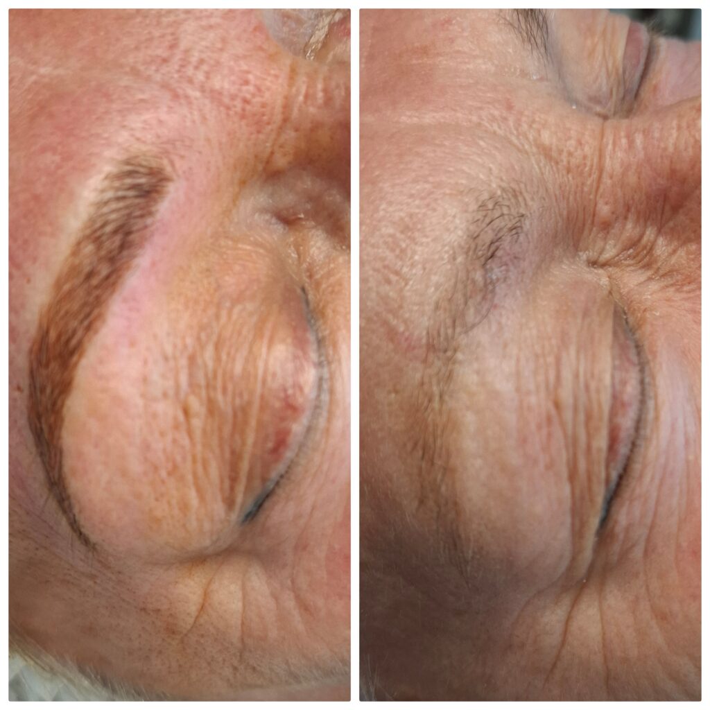 Microblading